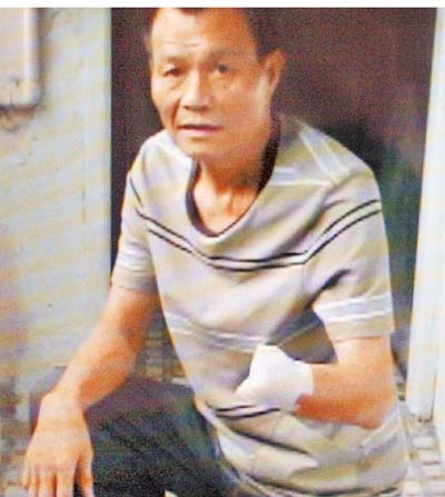 台湾男子锯断手掌诈保落空称“断手当垃圾丢”