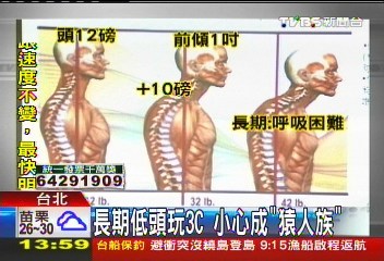 台湾医师:长期低头玩3C产品小心变“猿人族”