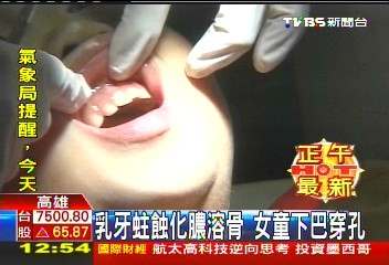 点图查看下一页