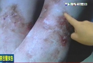 点图查看下一页