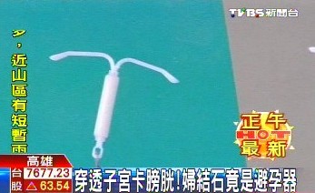 点图查看下一页