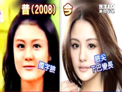 台女艺人宋纪妍闪婚嫁豪门被质疑曾整容(图)