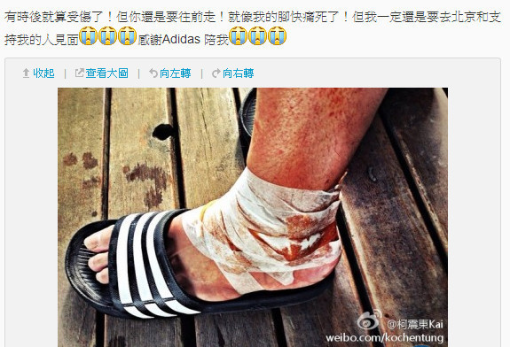 柯震东网传脚踝裹血照似未摆脱情伤阴霾(图)