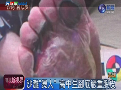 ���ձ�ɹɳ̲�������ո��۶����ο����˽ţ�ͼ��