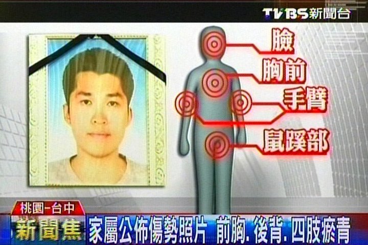 死亡役男全身瘀青家属公布伤势图质疑台军施虐