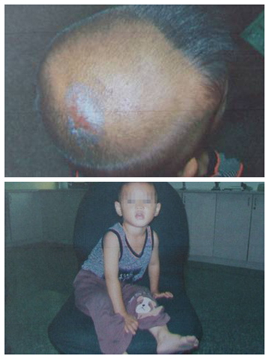 ������2����ӳ��������ӱ�ˤ���ҽ�ͷƤ����