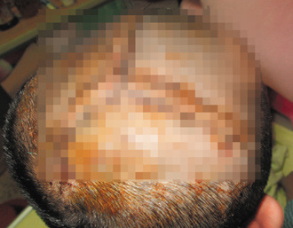 ̨��һ��¥��ǽ��ש�������Ůͯͷ�ǹǣ�ͼ��