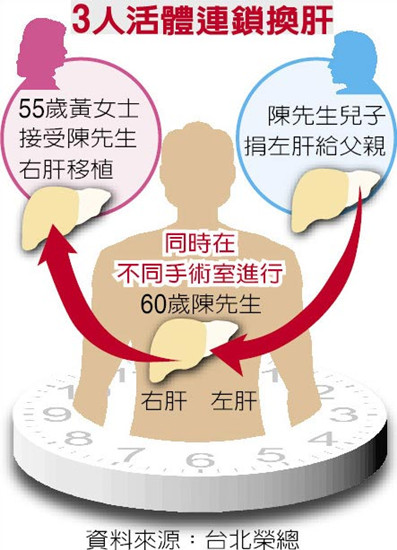 台北荣总医院完成台湾首例“3人活体连锁换肝”