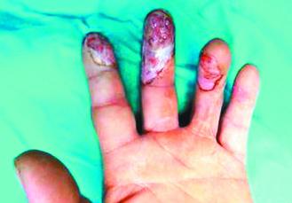 ���ӻ��շ�Ʒ����������ˮ���ս�֫��ͼ��