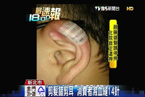 ���ӱ���������ʦ���˶��佦Ѫ����14�루ͼ��