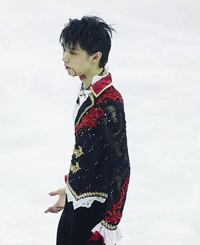 羽生结弦因碰撞五处受伤痊愈需2至3周(图)