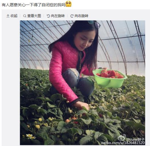 ��Ų̊������ԳƵ��Ա�֢���ѣ��������۲���