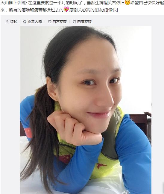 速滑美女张虹遭遇突发性耳聋拒绝消极乐观应对