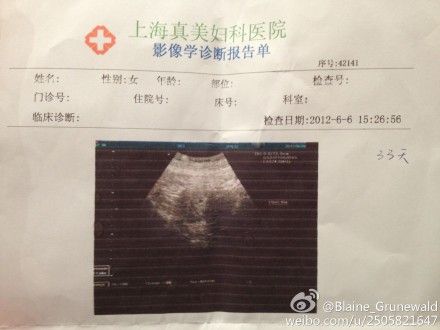 点图查看下一页