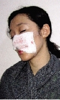 女演员剧组被藏獒咬伤引热议业内呼成立行业协会