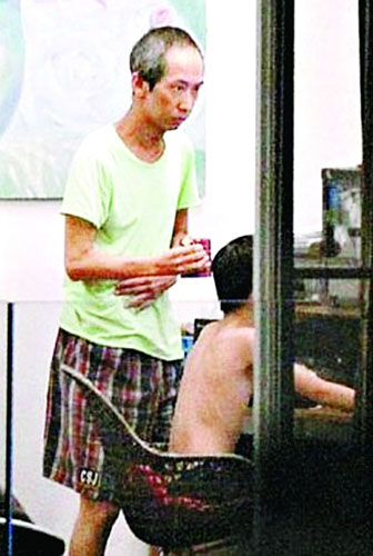 传金牌配角张达明患重症双颊凹陷身体暴瘦(图)