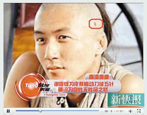 点图查看下一页