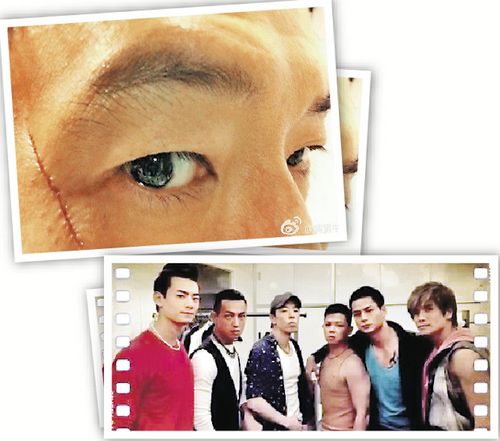 黄贯中拍“古惑仔”晒刀疤脸照片(图)