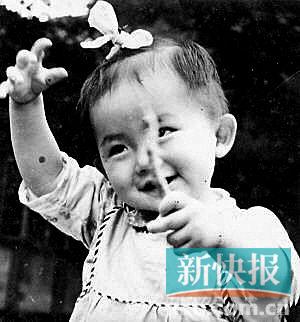 谢娜庆33岁生日晒童年萌照扎小辫喜感十足(图)