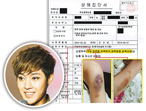 金贤重涉嫌殴打前女友女方伤势严重照片曝光(图)