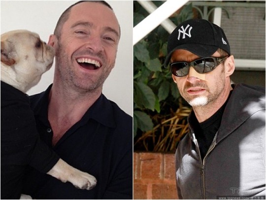 休·杰克曼皮肤癌复发:比想像中的更令人恐慌