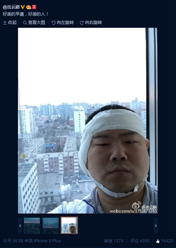 岳云鹏手术后头裹纱布自称“好美的人”(图)