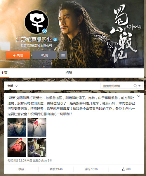 演员刘思彤因打戏受伤距离毁容只差几毫米(图)