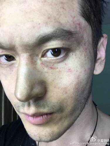 ����������ʱ�������Ѫ˿���ѣ�Baby���׾ͺ�