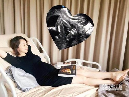 徐若瑄晒B超照称胎儿健康医生仍担忧其早产(图)