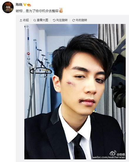 陈晓晒破相照嘴角现淤血网友有姑姑心疼你图