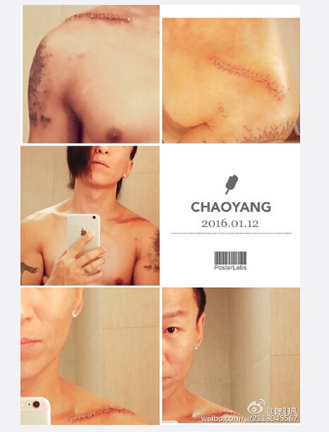 ���������������������ģ��ѽ���Ѫ��ֻ������